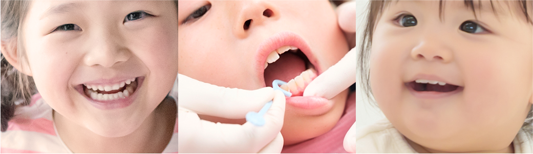 小児歯科イメージ